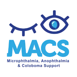 MACS