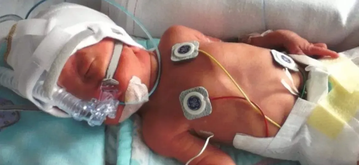 Bliss, for babies born premature or sick