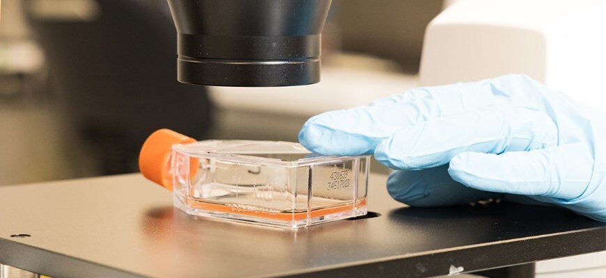 Brain Tumour Research
