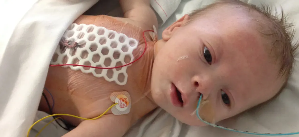 Children's Heart Surgery Fund