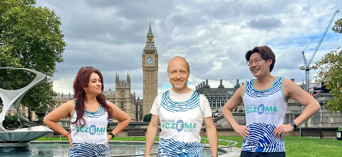 National Eczema Society