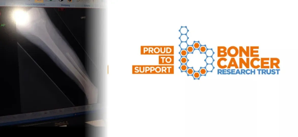 Bone Cancer Research Trust
