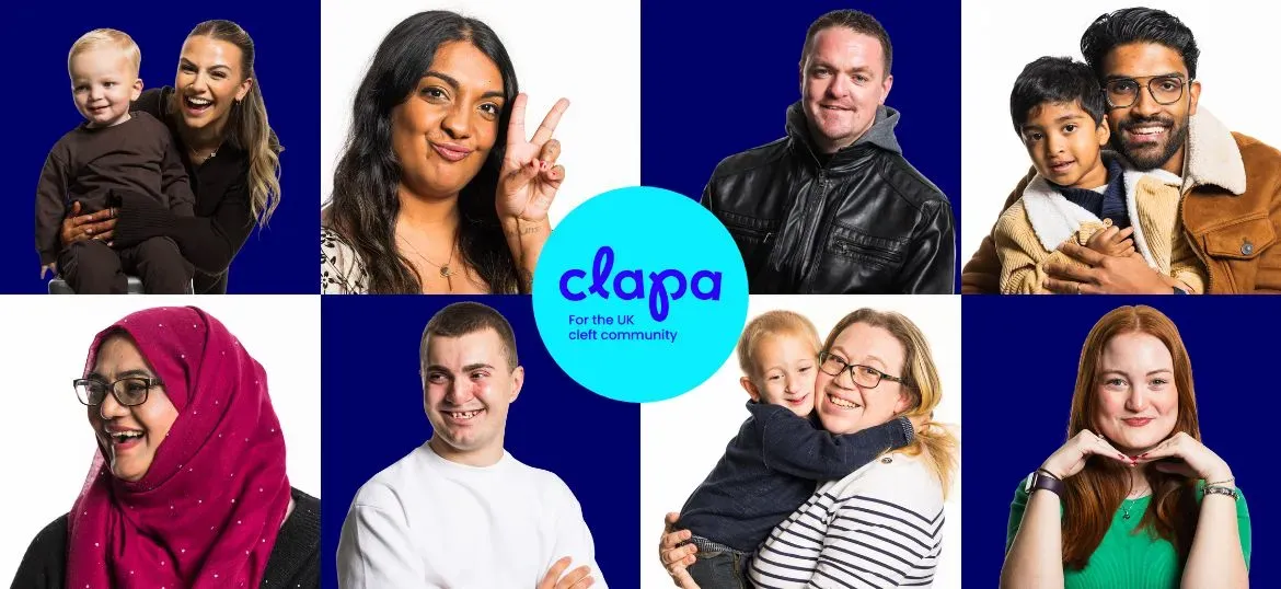 Cleft Lip and Palate Action (CLAPA)